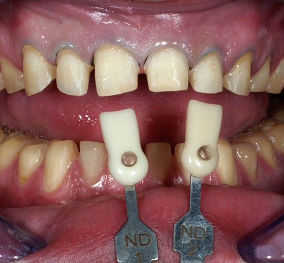 image-001